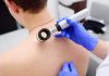 Cilt Kanseri ve Melanomlar Cilt Kanseri ve Melanomlar
