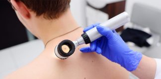 Cilt Kanseri ve Melanomlar Cilt Kanseri ve Melanomlar