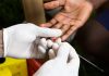 HIV Enfeksiyonu ve AIDS Nedenleri Ve Teşhisi HIV Enfeksiyonu ve AIDS Nedenleri Ve Teşhisi