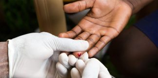HIV Enfeksiyonu ve AIDS Nedenleri Ve Teşhisi